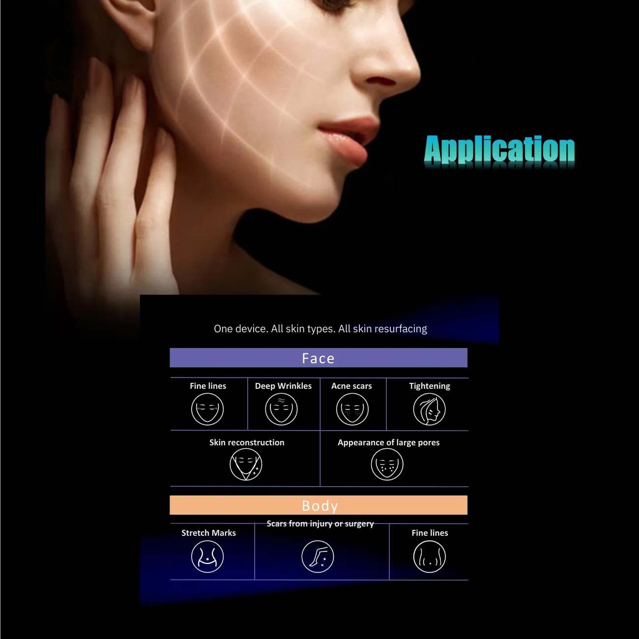 Proteus-V RF Micro-needle   Thermagia Fractional RF System